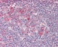 RPL23 / L23 Antibody (C-Terminus)